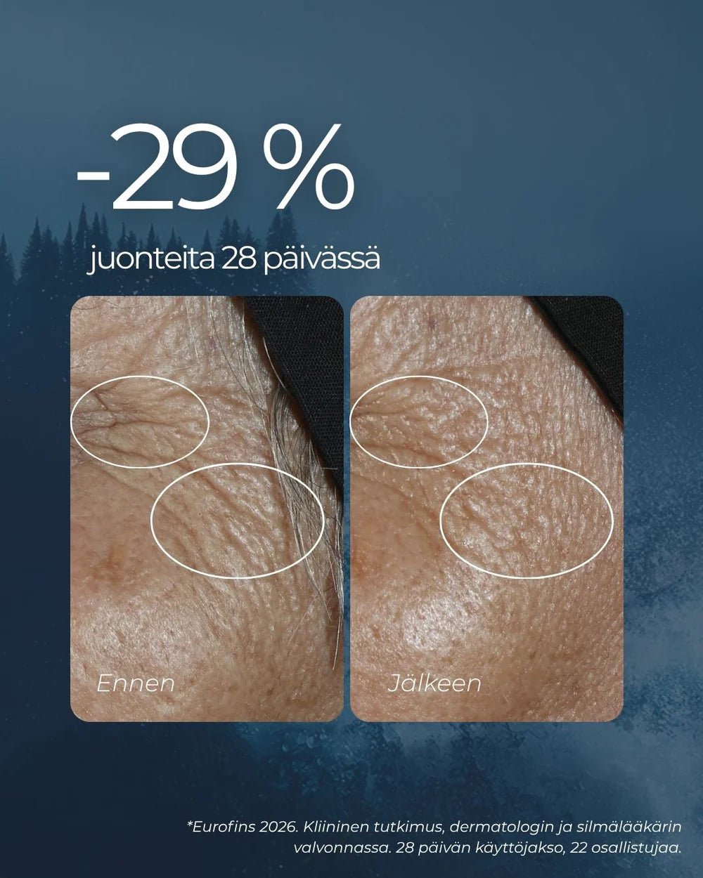 RAKKOHAURU SILMÄNYMPÄRYSVOIDE roll-on 10 ml