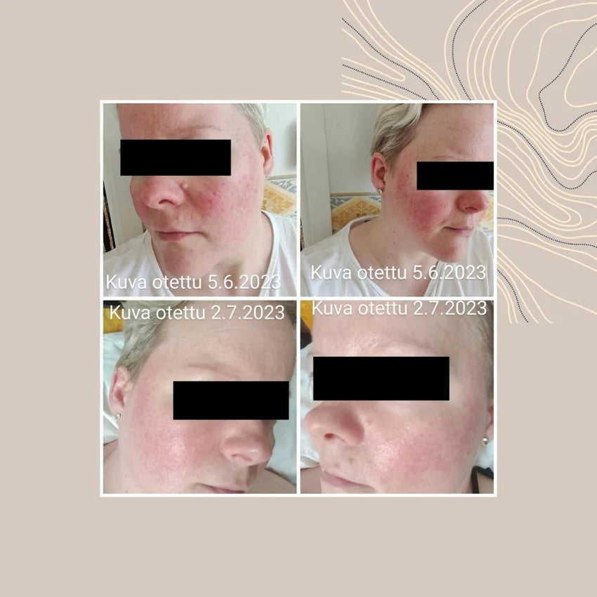 TYRNI LUKSUS SPA saippua - ruusufinni-iholle 90 g