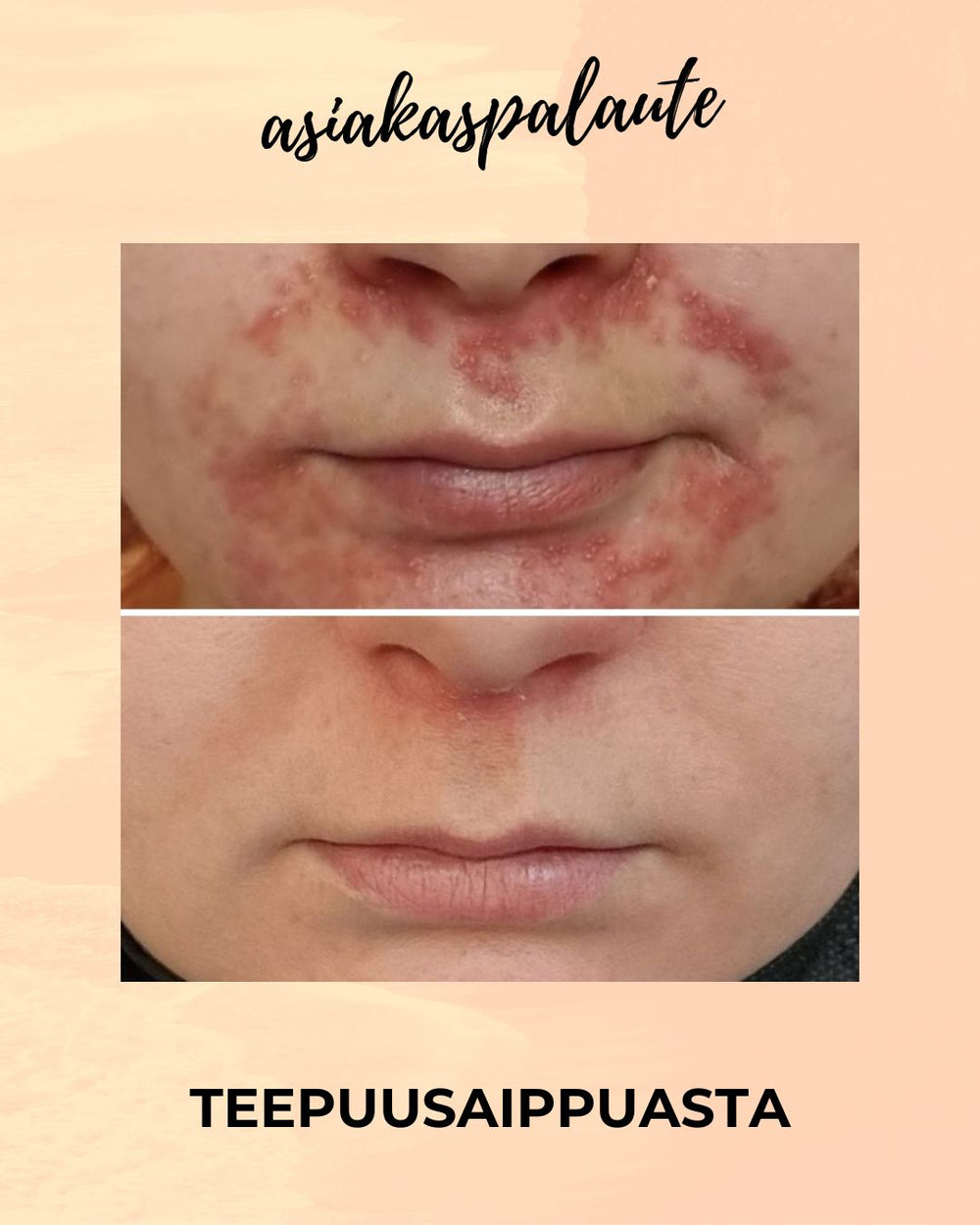 TEEPUUSAIPPUA 90 g – Saaren Taika
