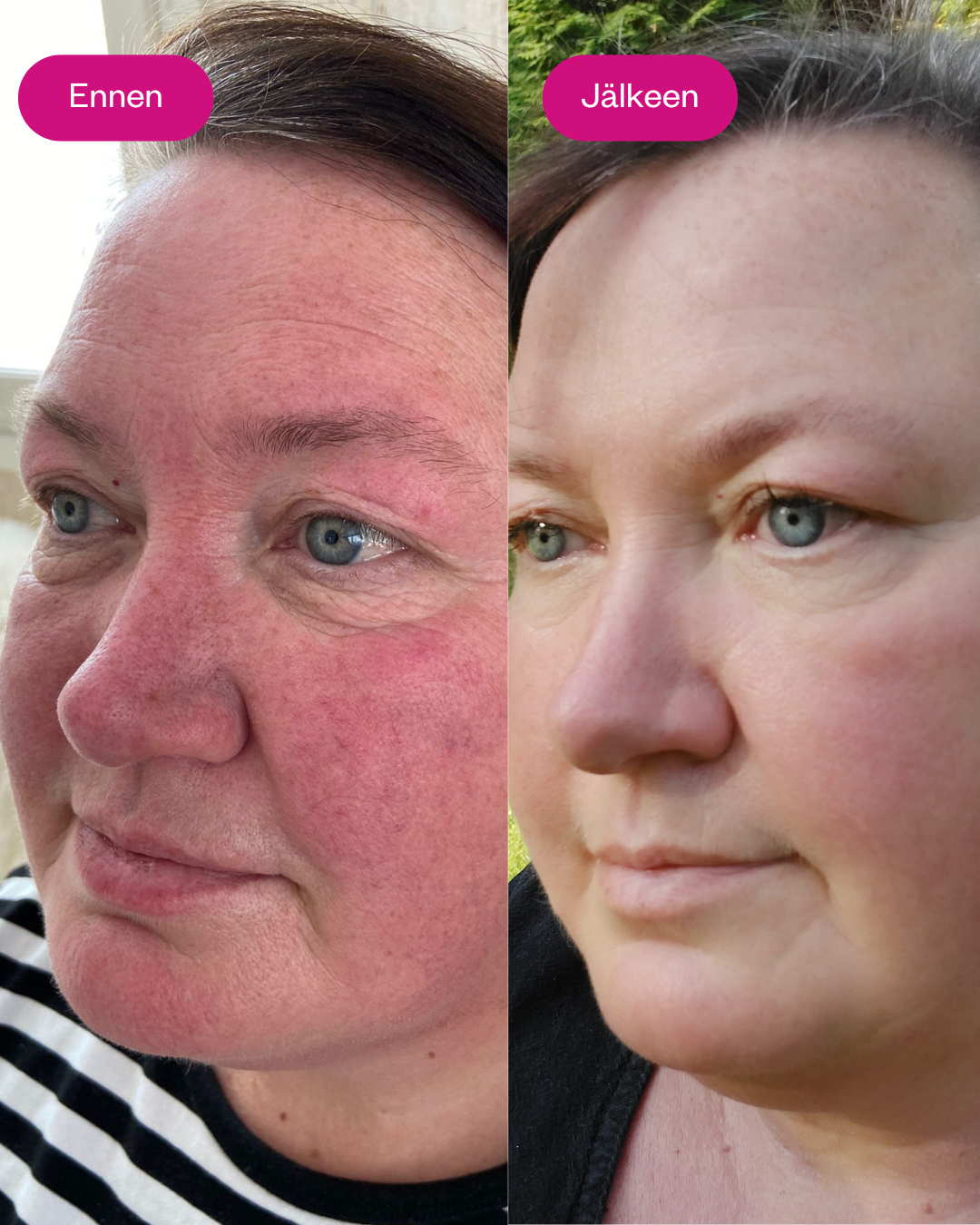 RETIN LIFT 3-in-1 CREAM kasvovoide ikääntyvälle iholle 50 ml