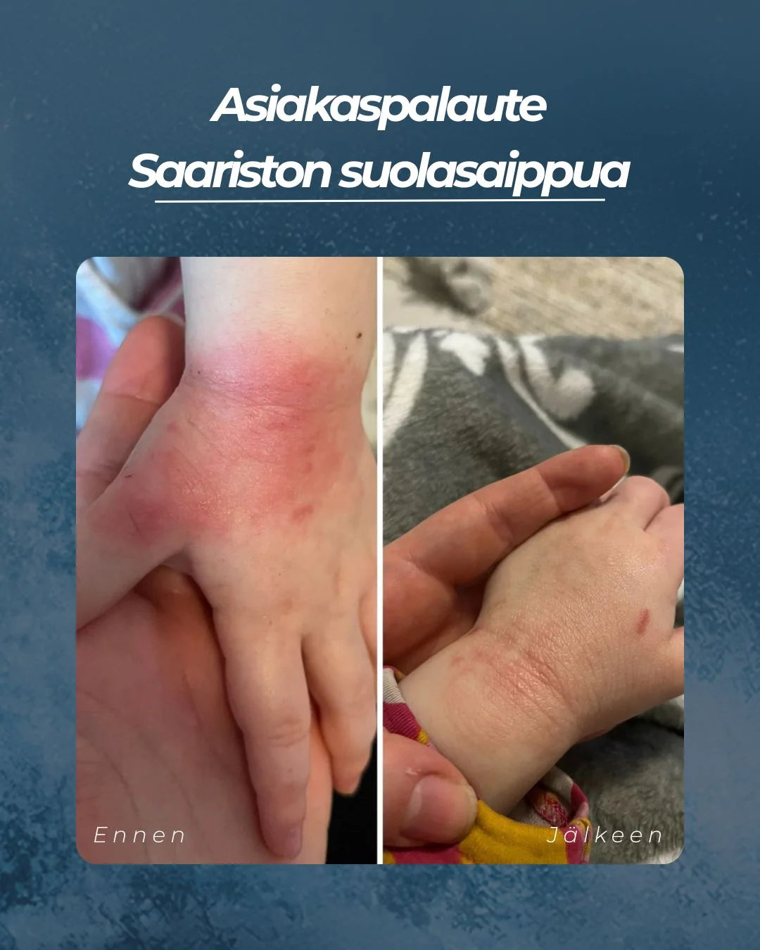 SAARISTON SUOLASAIPPUA® 100 g – Hajusteeton suolasaippua kuivalle, herkälle ja atooppiselle iholle