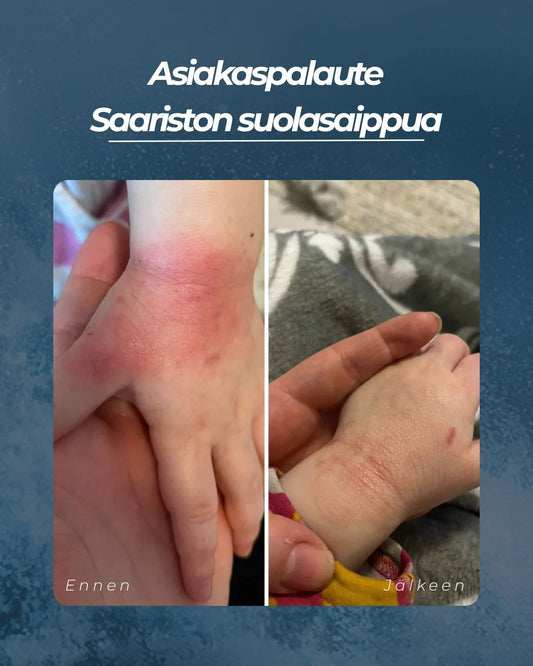 SAARISTON SUOLASAIPPUA® 100 g – Hajusteeton suolasaippua kuivalle, herkälle ja atooppiselle iholle