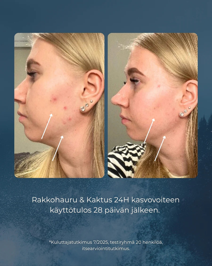 RAKKOHAURU KASVOSETTI - Anti-age seerumi & 24h voide