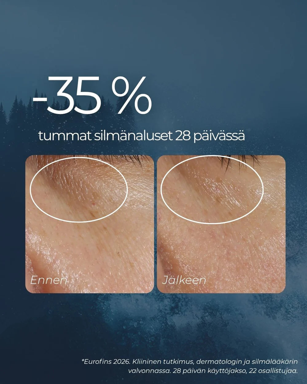 RAKKOHAURU SILMÄNYMPÄRYSVOIDE roll-on 10 ml