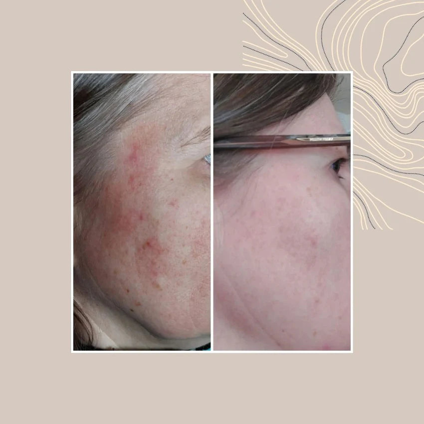 TYRNI LUKSUS SPA saippua - ruusufinni-iholle 90 g
