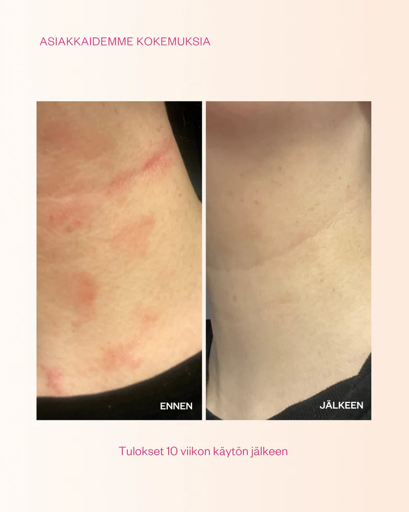 PROPOLIS & PROBIOTICS Rescue Cream 120 ml
