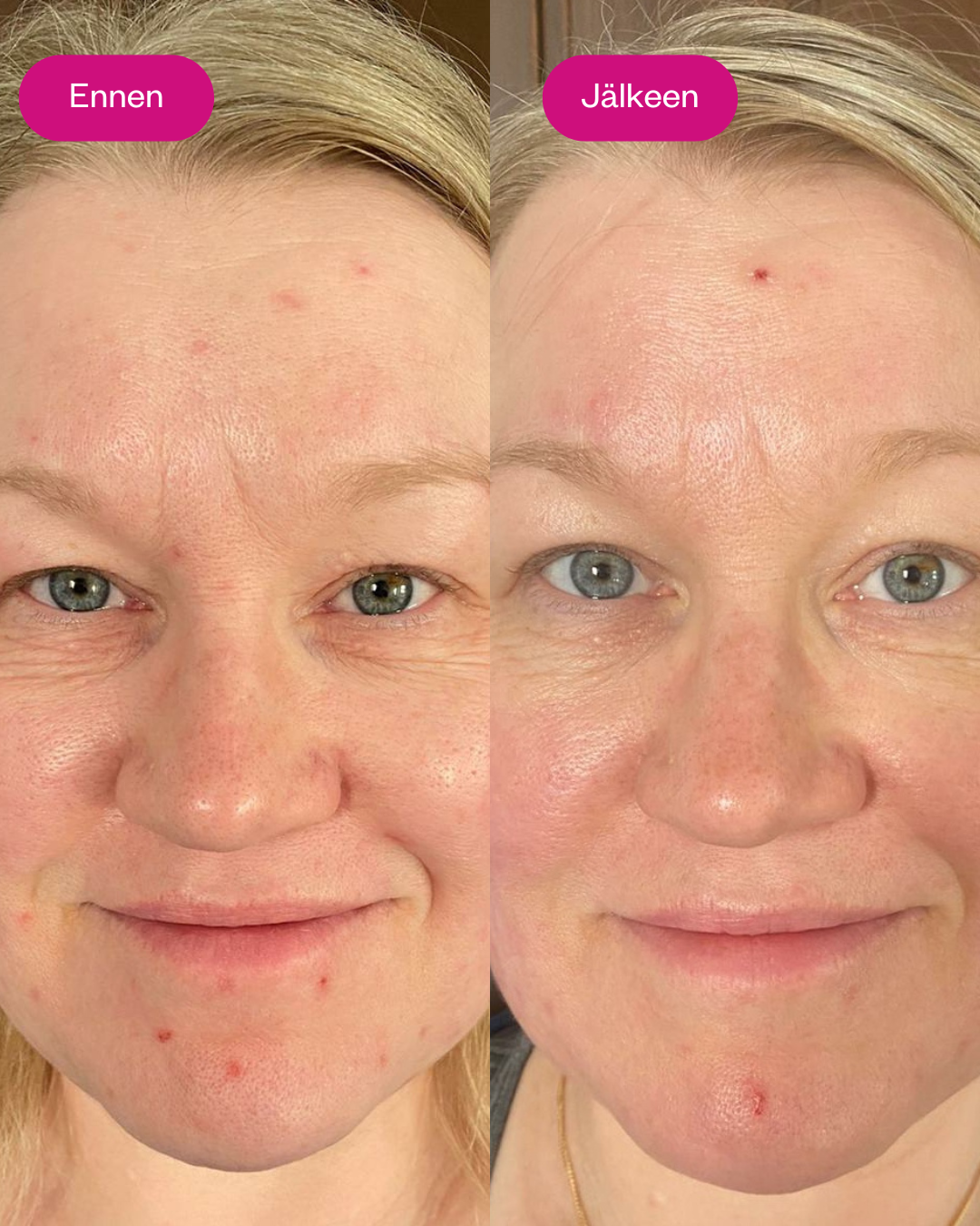 RETIN LIFT 3-in-1 CREAM kasvovoide ikääntyvälle iholle 50 ml